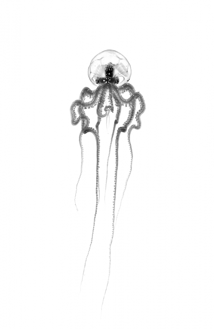 X-ray